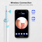 Intelligent Ear Cleaner | Safe, Gentle, Effective