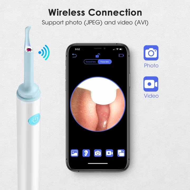 Intelligent Ear Cleaner | Safe, Gentle, Effective