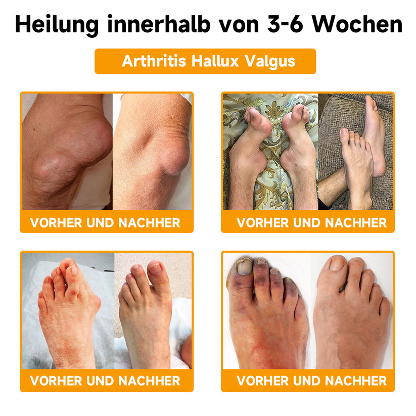 Bienen-Vital-Creme | Quick Pain Relief