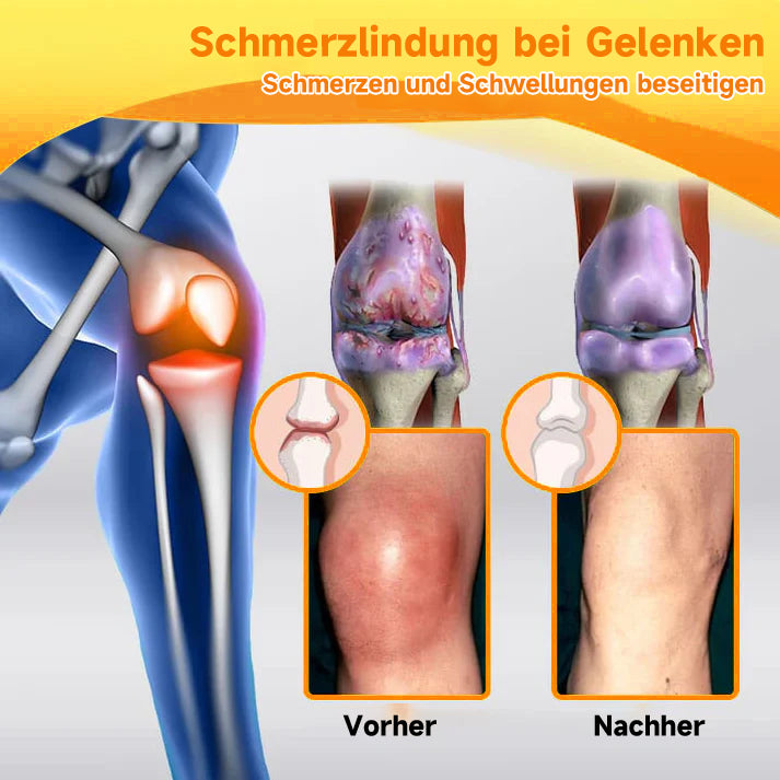 Bienen-Vital-Creme | Quick Pain Relief