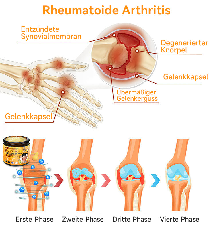 Bienen-Vital-Creme | Quick Pain Relief