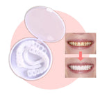 SmileSnap - Always the perfect smile with these veneers