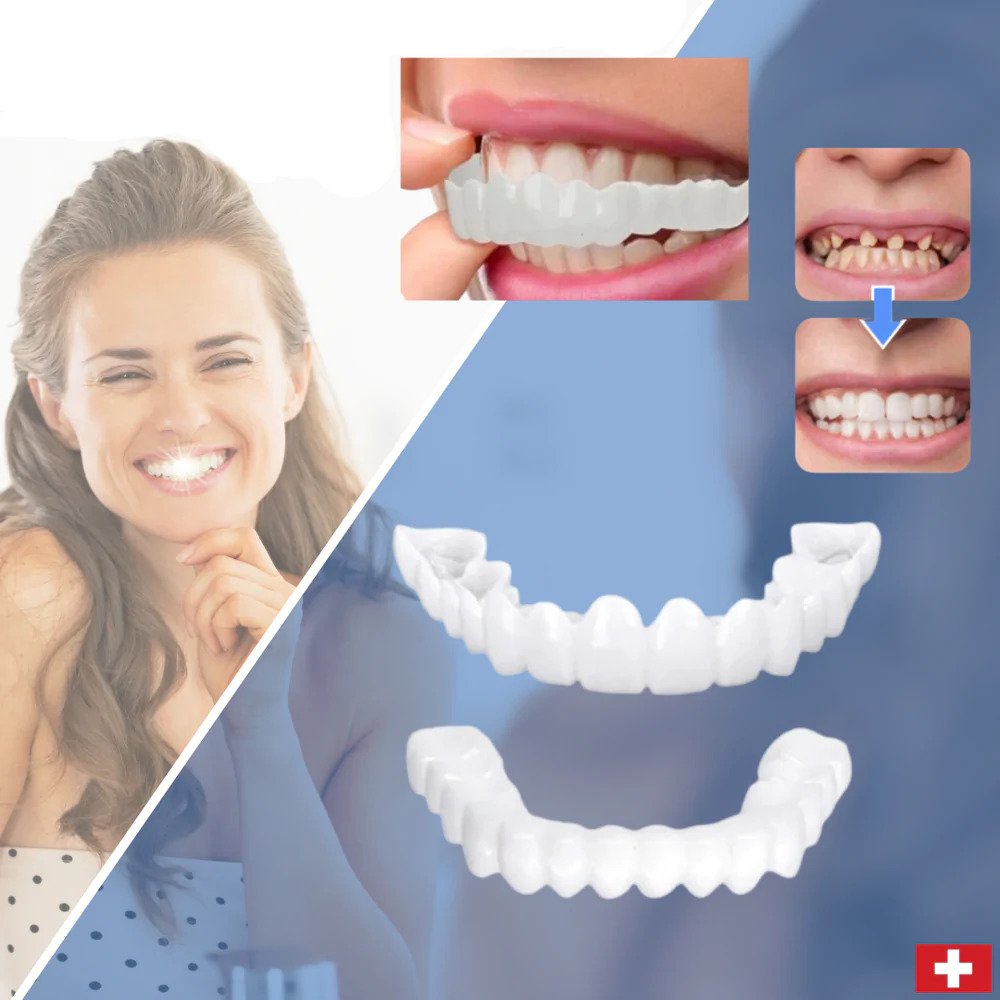 SmileSnap - Always the perfect smile with these veneers