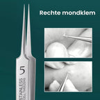 TweezeClear Targeted Blemish Extraction