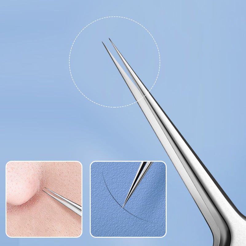 TweezeClear Targeted Blemish Extraction