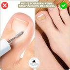 ALIGNSTRIP – Painless Nail Correction Strips for Ingrown & Deformed Nails