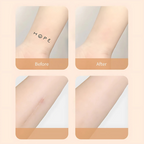 Waterproof Scar Concealer Patches with 13 × 8.5 cm Polyurethane Film