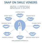 Removable Smile Veneers for Upper and Lower Teeth