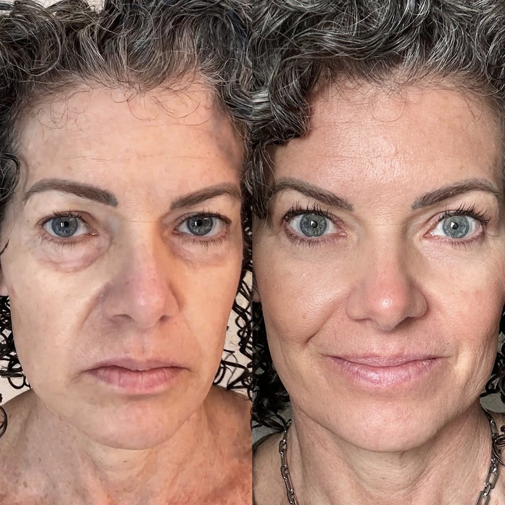 EyeRevive | Radiance and freshness regained