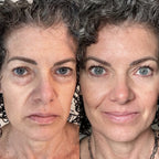 EyeRevive | Radiance and freshness regained