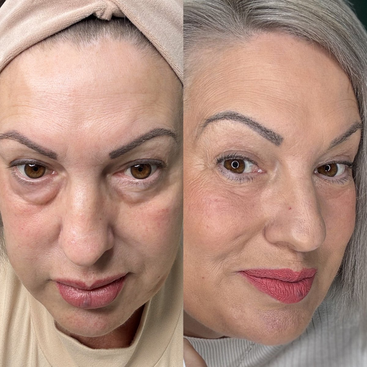 EyeRevive | Radiance and freshness regained