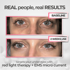 EyeRevive | Radiance and freshness regained
