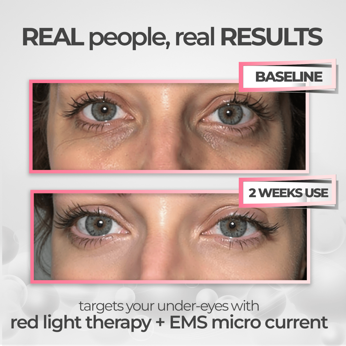 EyeRevive | Radiance and freshness regained