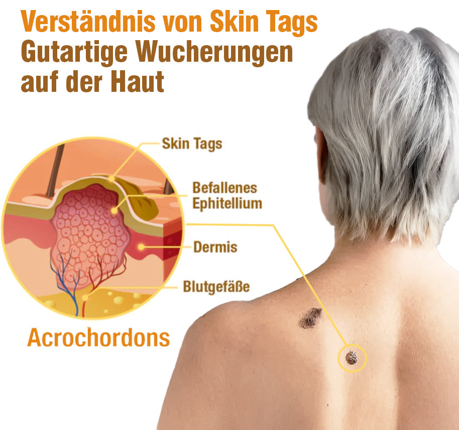 TagRecede Bee Gift Spray | Natural Skin Perfection