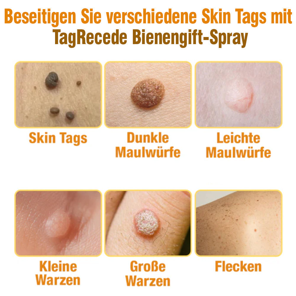 TagRecede Bee Gift Spray | Natural Skin Perfection
