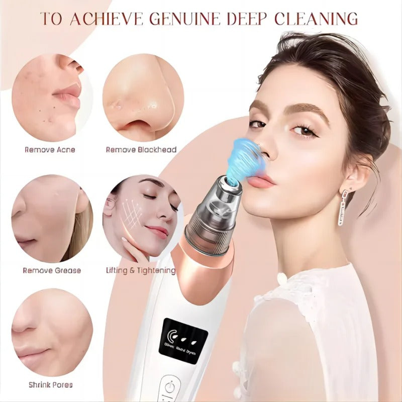 Blackhead Remover Vacuum Pore Cleaner | Adjustable Suction, Multi-Functional Tool for Deep Cleansing & Acne Treatment at Home