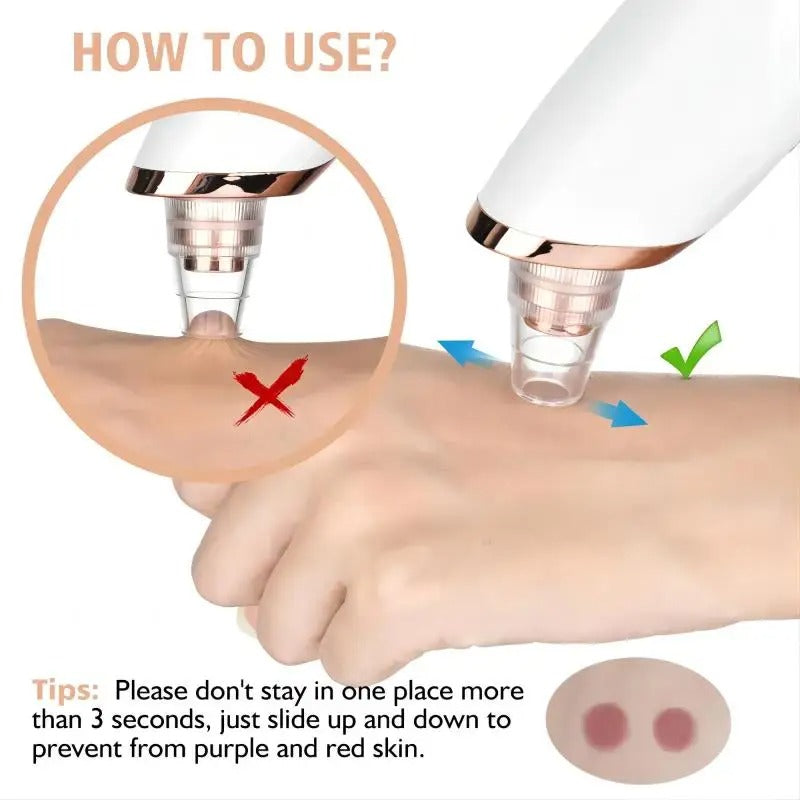 Blackhead Remover Vacuum Pore Cleaner | Adjustable Suction, Multi-Functional Tool for Deep Cleansing & Acne Treatment at Home