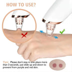 Blackhead Remover Vacuum Pore Cleaner | Adjustable Suction, Multi-Functional Tool for Deep Cleansing & Acne Treatment at Home