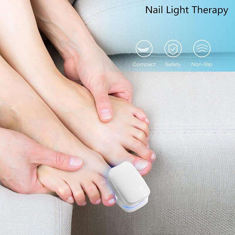 Laser device for nail fungus cleaning – Revolutionary, highly efficient light therapy device from Expert for toe nail conditions