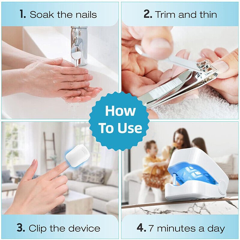 Laser device for nail fungus cleaning – Revolutionary, highly efficient light therapy device from Expert for toe nail conditions