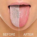 Oral Flex