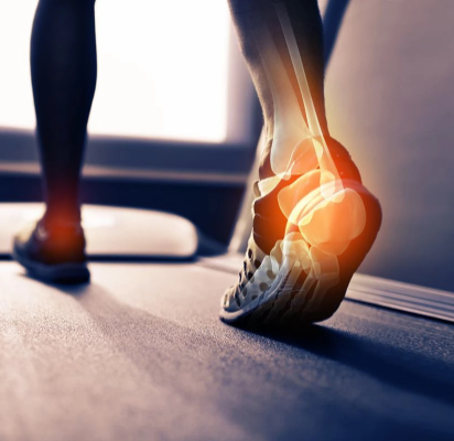 FootFlex Comfort Band – Supportive Foot Band against Heel Pain