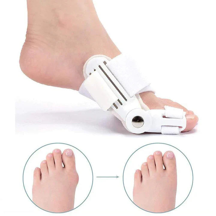 Hallux Valgus correction splint (1 pair)