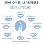Smile Veneer (Upper & Lower Included)