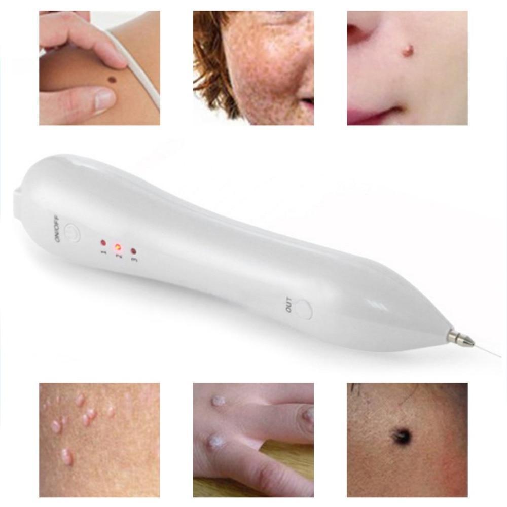 Laser Mole & Freckle Remover Warts, Age Spots, Dark Spots