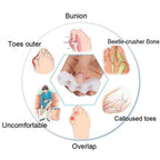 Toe Recovery | Orthopedic Hallux and Hammer Toe Corrector with Toe Separator