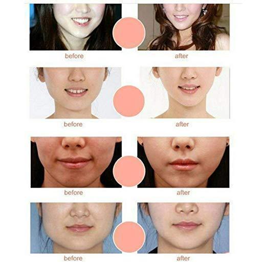 V Line Chin Up Face Lift Mask