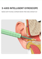 Smart Visual Endoscope