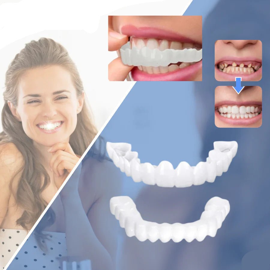 SnapFit Dental Restoration – Perfect Smile Without Dentist Visits