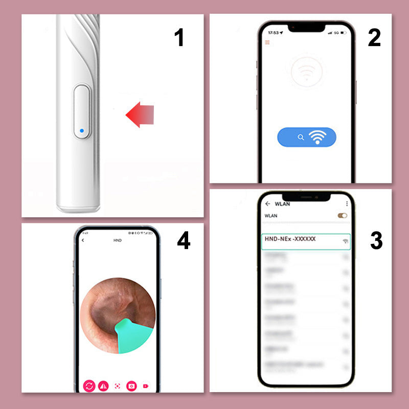 Device for earwax removal with HD camera