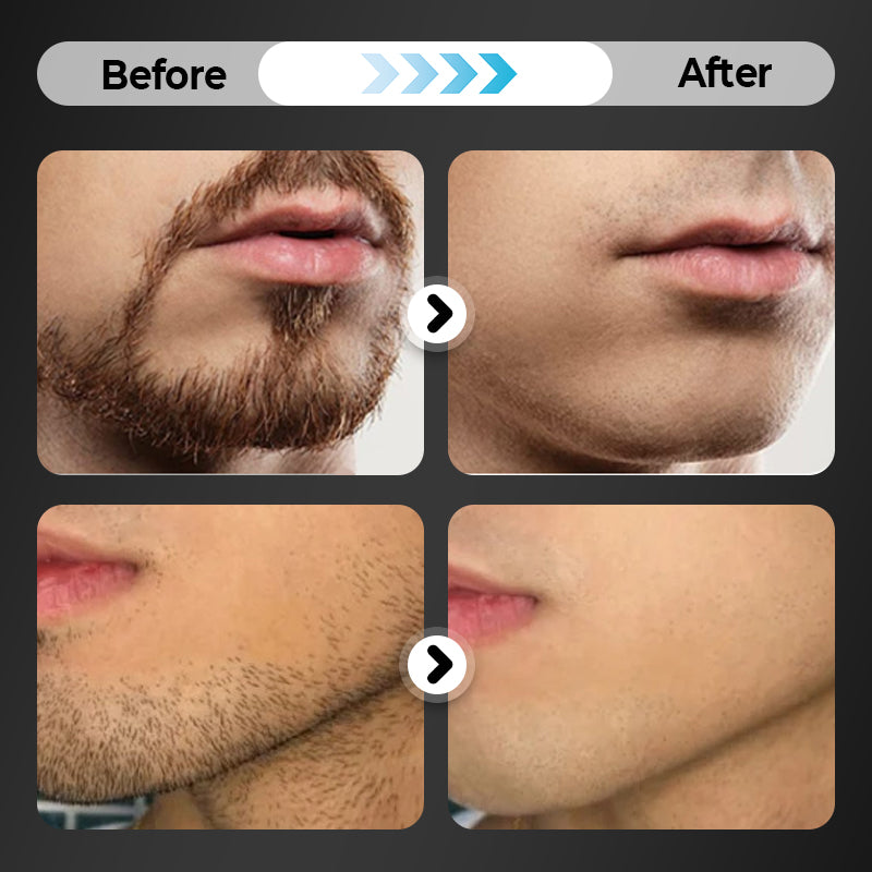 6-blade razor with single snap-in head